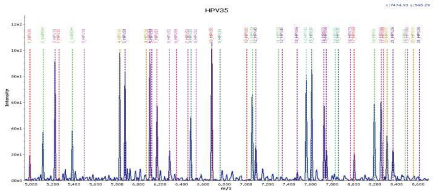 Typing Detection of HPV